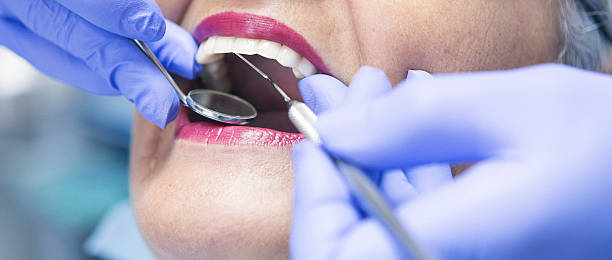 Best Emergency Root Canal Therapy in Akwesasne, NY